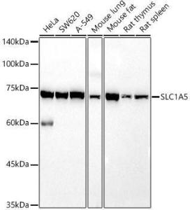 Western blot analysis of extracts of various cell lines, using Anti-SLC1A5 / ASCT2 Antibody (A12054) at 1:1,000 dilution. The secondary antibody was Goat Anti-Rabbit IgG H&L Antibody (HRP) at 1:10,000 dilution.