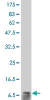 Anti-CXCL8 Mouse Monoclonal Antibody [clone: 4G11]