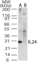 Anti-IL24 Rabbit Polyclonal Antibody