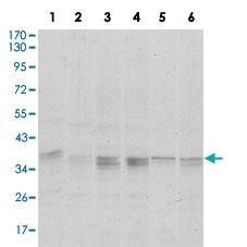 Anti-PPP1CA Mouse Monoclonal Antibody [clone: 5E9]