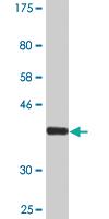 Anti-DTYMK Mouse Monoclonal Antibody [clone: 2C2]