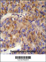 Anti-MINPP1 Rabbit Polyclonal Antibody (Biotin)