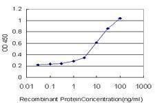 Anti-FOXO3 Mouse monoclonal antibody [clone: 2H2]