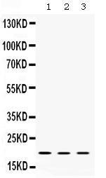 Anti-Cofilin 2 Antibody