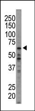 Anti-EIF2AK1 Rabbit Polyclonal Antibody