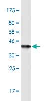 Anti-DTYMK Mouse Monoclonal Antibody [clone: 2G11]