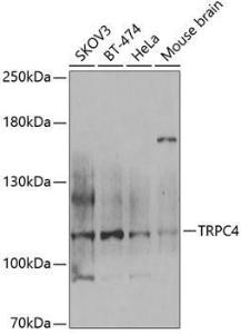 Western blot analysis of extracts of various cell lines, using Anti-TRPC4 Antibody (A12055) at 1:1000 dilution. The secondary Antibody was Goat Anti-Rabbit IgG H&L Antibody (HRP) at 1:10000 dilution. Lysates/proteins were present at 25 µg per lane