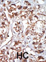 Anti-EIF2AK1 Rabbit Polyclonal Antibody