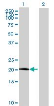 Anti-ARL5B Mouse Polyclonal Antibody