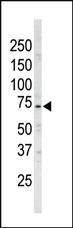 Anti-NUAK1 Rabbit Polyclonal Antibody