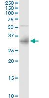 Anti-SULT1E1 Rabbit Polyclonal Antibody