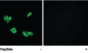 Anti-DAB1 Rabbit Polyclonal Antibody