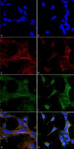 Anti-4-Hydroxy-2-hexenal antibody