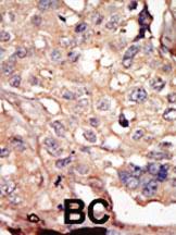 Anti-NUAK1 Rabbit Polyclonal Antibody