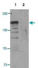 Anti-ROCK1 Rabbit Polyclonal Antibody