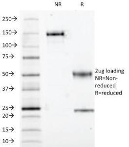 SDS-PAGE analysis of Anti-S100A1 Antibody [S100A1/1942] under non-reduced and reduced conditions; showing intact IgG and intact heavy and light chains, respectively. SDS-PAGE analysis confirms the integrity and purity of the antibody.