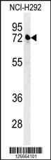 Anti-KLHL24 Rabbit Polyclonal Antibody