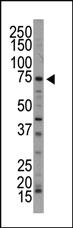 Anti-NUAK1 Rabbit Polyclonal Antibody