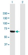 Anti-PGM3 Mouse Polyclonal Antibody