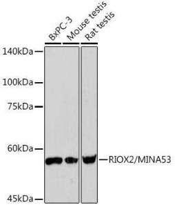 Anti-ROX Rabbit Monoclonal Antibody [clone: ARC2336]