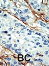 Anti-NUAK1 Rabbit Polyclonal Antibody