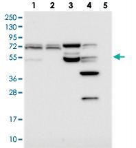 Anti-C16ORF46 Rabbit Polyclonal Antibody