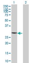 Anti-TOLLIP Mouse Polyclonal Antibody