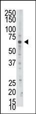 Anti-PAPSS2 Rabbit Polyclonal Antibody (FITC (Fluorescein))