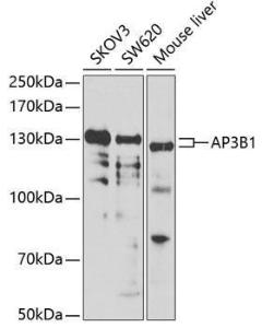 Western blot analysis of extracts of various cell lines, using Anti-HPS2 Antibody (A12057) at 1:1000 dilution