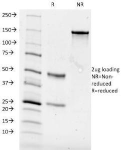 SDS-PAGE analysis of Anti-CD84 Antibody [153-4D9] under non-reduced and reduced conditions; showing intact IgG and intact heavy and light chains, respectively. SDS-PAGE analysis confirms the integrity and purity of the Antibody