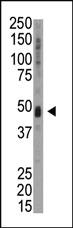 Anti-UHMK1 Rabbit Polyclonal Antibody