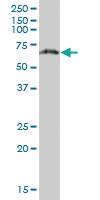 Anti-PGM3 Mouse Polyclonal Antibody