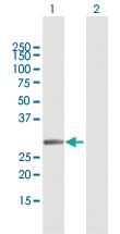 Anti-MMS19 Mouse Polyclonal Antibody