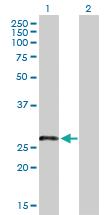 Anti-LRRN4CL Mouse Polyclonal Antibody