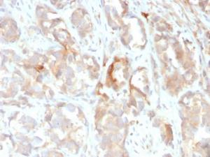 Immunohistochemical analysis of formalin-fixed, paraffin-embedded human prostate using Anti-Cytokeratin 6B Antibody [KRT6B/2116]