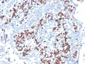 Immunohistochemical analysis of formalin-fixed, paraffin-embedded human tonsil using Anti-CD5L Antibody [CD5L/2991]