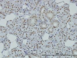 Anti-SMC1A Mouse Monoclonal Antibody [clone: 1B9]