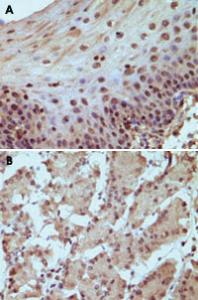 Anti-RB1 Mouse Monoclonal Antibody [clone: 7E4B8]