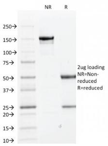 SDS-PAGE analysis of Anti-Cytokeratin 1 Antibody [KRT1/1840] under non-reduced and reduced conditions; showing intact IgG and intact heavy and light chains, respectively. SDS-PAGE analysis confirms the integrity and purity of the antibody