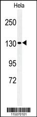 Anti-L1TD1 Rabbit Polyclonal Antibody