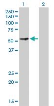 Anti-PGM3 Rabbit Polyclonal Antibody