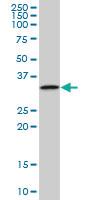 Anti-TOLLIP Mouse Polyclonal Antibody