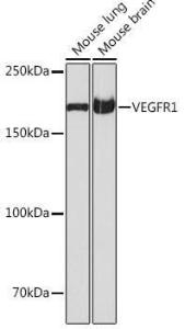 Western blot analysis of extracts of various cell lines, using Anti-VEGF Receptor 1 Antibody [ARC0363] (A307992) at 1:1,000 dilution