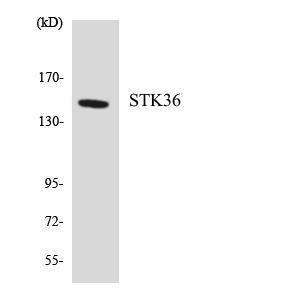 Western blot analysis of the lysates from HepG2 cells using Anti-STK36 Antibody