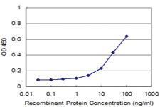 Anti-TOPORS Mouse Monoclonal Antibody [clone: 1A5]