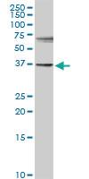 Anti-SULT1E1 Rabbit Polyclonal Antibody