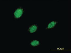 Anti-LHX5 Mouse Monoclonal Antibody [clone: 2A8]