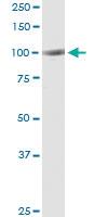 Anti-FGD3 Polyclonal Antibody Pair