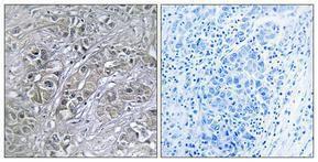 Antibody anti-serpin A5 100 µg