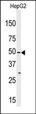 Anti-MLKLAK Rabbit Polyclonal Antibody